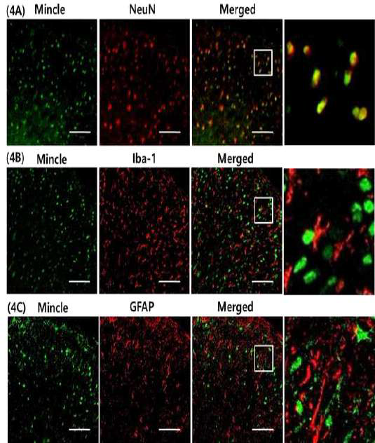 Double immunofluorescence study에서 Mincle은 NeuN 양성세포와 colocalization 하였지만, Iba-1 또는 GFAP 양성세포에서는 expression 되지 않았다