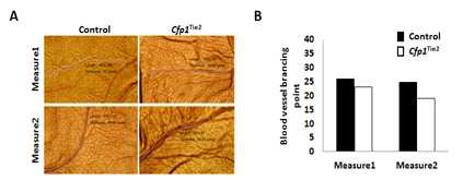 CFP1과 혈관내피세포 분화 및 혈관형성