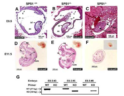 Morphological differences in embryos generated from crosses between Sps1+/− mice. Images from sagittal sections of E8.5 SPS1 wild type (A), heterozygous (B), and knockout mice (C), and E11.5 SPS1 wild type (D), heterozygous (E), and knockout embryos (F). Insets in (D), (E), and (F) designate whole embryos. The length of each scale bar is indicated on the bar. (G) Genotypes of E8.5 embryos were determined by PCR. As described in the Experimental section, embryo fragments were captured, genomic DNA was isolated, and PCR was performed using two sets of primers. Embryo fragments used in Figure 1G were captured from the embryos in Figures 1A, B, and C. Epc, ectoplacental cone; exc, exocoelom; pac, postamniotic cavity; a, amnion; ac, amniotic cavity; am, amniotic membrane; c, chorion; al, allantois; hf, headfold; fb, forebrain; hb, hindbrain; ht, heart; Li, liver; som, somite