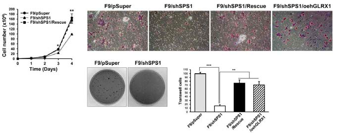 analysis of cancer characteristics of F9 SPS1 knockdown cell lines (A) cellular growth rate of F9 SPS1 knockdown cell line was measured by MTT assay. SPS1 knockdown promotes retarded cellular growth and the growth was rescued by SPS1 or GLRX1 over expression. (B) analysis of malignancy characteristics of F9 SPS1 knockdown cell lines. SPS1 deficient F9 cells significantly inhibited malignancy characteristics by soft agar assay and invasion assay