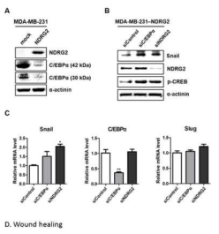 Effect of C/EBPα knockdown on NDRG2-induced Snail down-regulation in NDRG2-overexpressing MDA-MB-231 cells. (A) The expression level of C/EBPα in MDA-MB-231-mock and MDA-MB-231-NDRG2 cells was confirmed by western blot analysis using C/EBPα specific antibodies. NDRG2-overexpressing MDA-MB-231 cells were transfected with control-siRNA, C/EBPα-siRNA, and NDRG2-siRNA using the DharmaFECT reagent for 24 h, and then the mRNA and protein level of cells was analyzed by using (B) western blot analysis and (C) real-time PCR