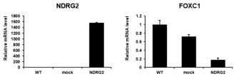 Expression of NDRG2 and FOXC1 in MDA-MB-231 cells The expression level of NDRG2 and FOXC1 in MDA-MB-231 cells was measured by real-time PCR