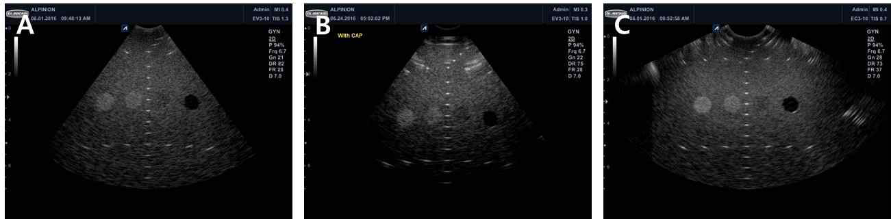 기기를 팬텀에 접촉하여 획득한 영상 (A), 기기에 물주머니를 장착한 상태에서 팬텀에 접촉하여 획득한 영상 (B), 일반 진단 초음파를 팬텀에 접촉하여 획득한 영상 (C)