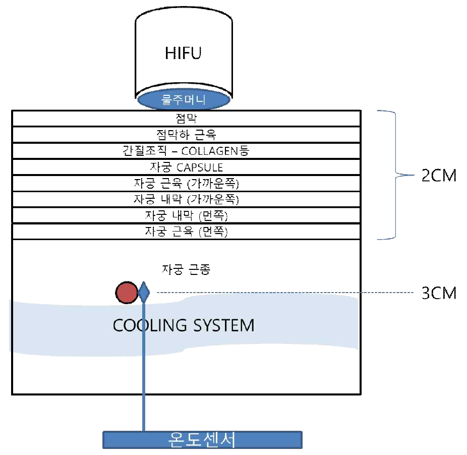 팬텀의 구조. 개방된 공간. HIFU PROBE 가 개방된 공간에 있어 온도가 잘 냉각됨