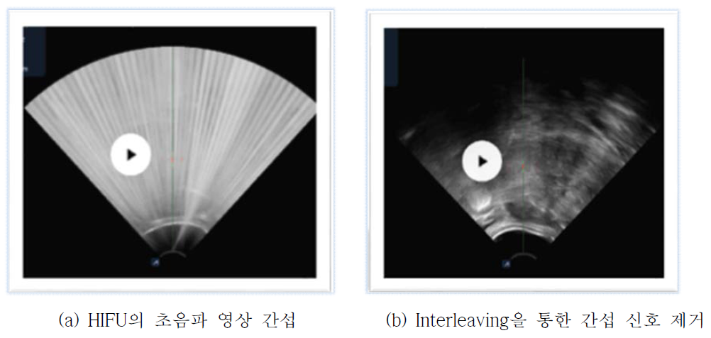 Interleaveing 효과