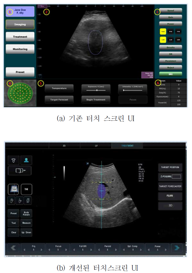 터치 스크린 UI 디자인 개선