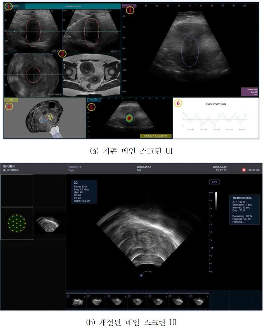 Monitor UI 디자인 개선