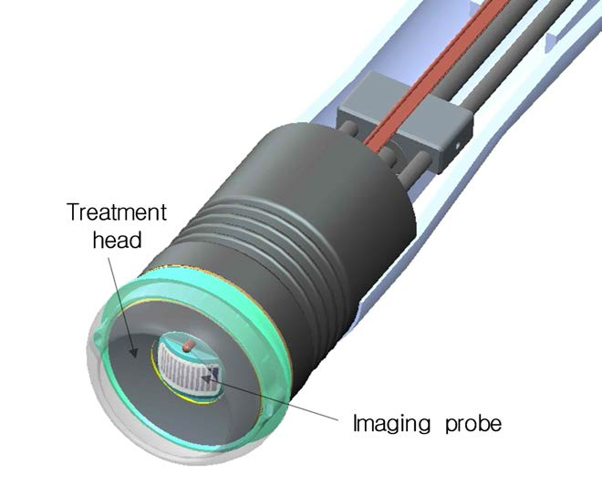 치료헤드의 구조