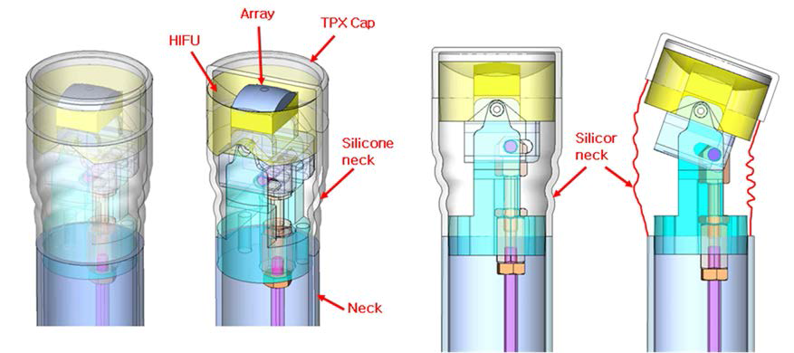 Silicone neck