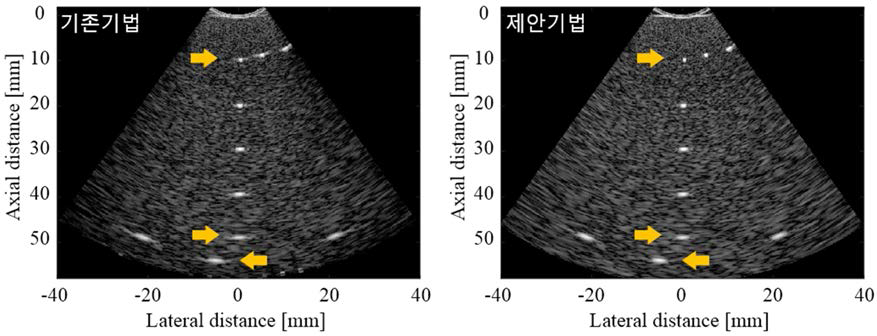 기존 고정송신집속 기법 및 transvaginal Planewave 기법의 in-vitro 실험 결과