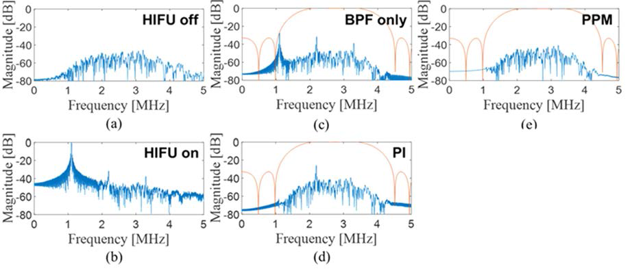HIFU 간섭제거 확인을 위한 frequency spectrum 비교 결과