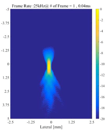 획득된 실제 cavitation data를 이용하여 수행한 PAM 결과