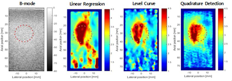 B-mode영상 및 기존 기법인 linear regression, level curve와 제안방법인 quadrature detection을 사용하여 복원한 shear wave speed map