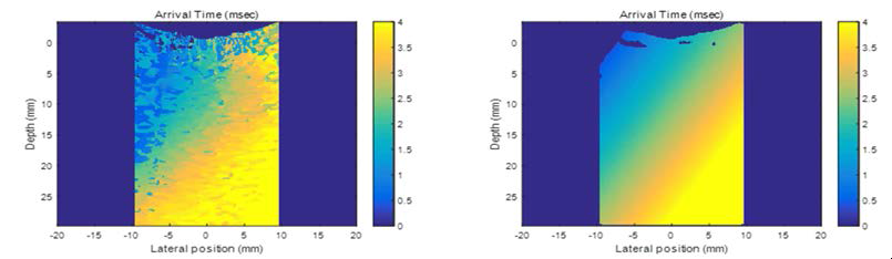 Plane fitting 전(좌측)과 후(우측)의 Shear wave 도달 시간 영상