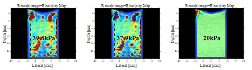 기존 방법의 Thresholding 전(좌측)과 후(중간), 제안하는 방법(우측)의 탄성도 영상