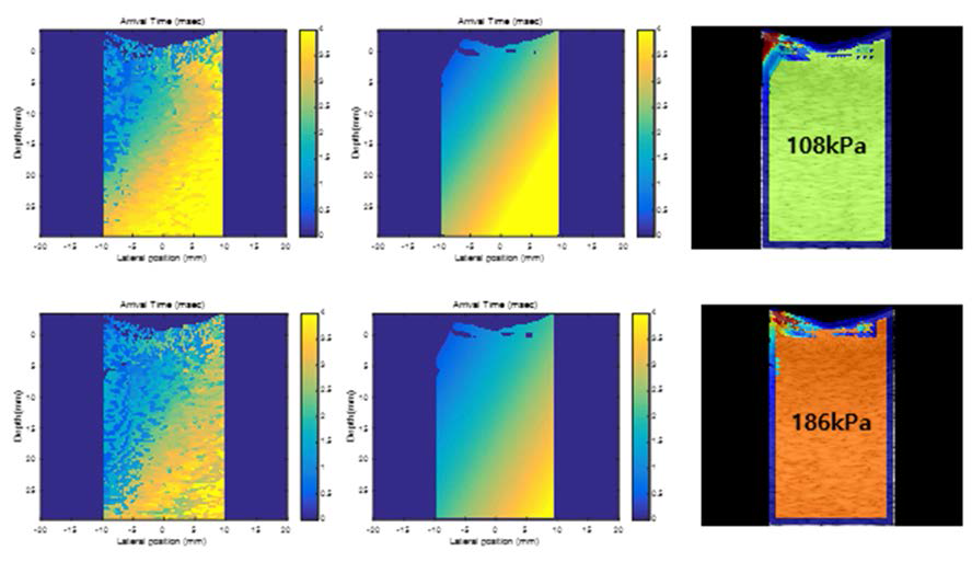 Agar 함유량이 2%(위), 3%(아래)일 때, fitting 전(좌측), 후(중간)의 도달 시간 영상과 평균 탄성도(우측) 영상