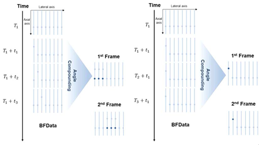 기존 방법(좌측)과 제안하는 방법(우측)의 Angle compounding 과정
