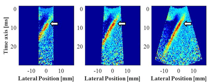 Compounding Angle 개수를 1(좌측), 5(중간), 21(우측)개 사용했을 때 특정 시간에서의 Displacement map