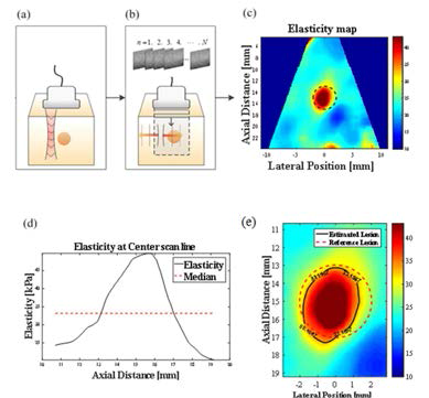 (a) 횡파 발생, (b) 횡파 발생 후 연속적인 초음파 영상 획득, (c) 탄성도 영상, (d) Lesion edge 탄성도 값 추정, (e) Estimated Lesion과 Reference Lesion