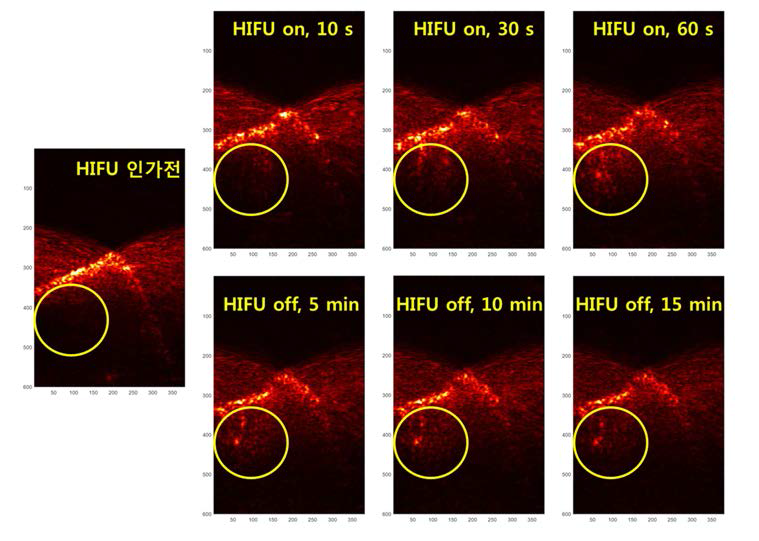 Photoacoustic 실험 결과