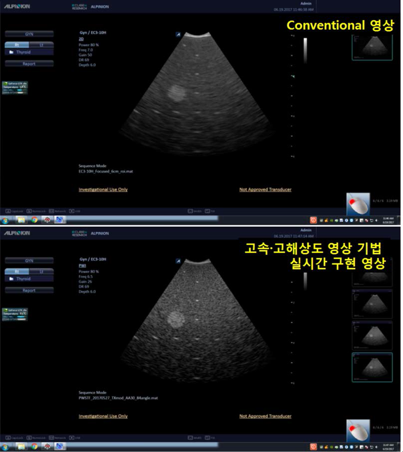 고속․고해상도 초음파 영상 기법 실시간 구동 영상