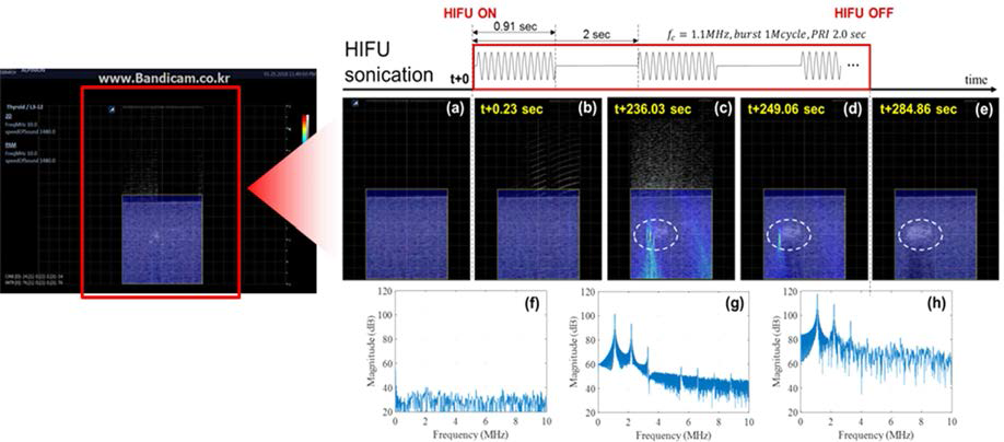 cavitation monitoring 기법 실시간 구동 영상