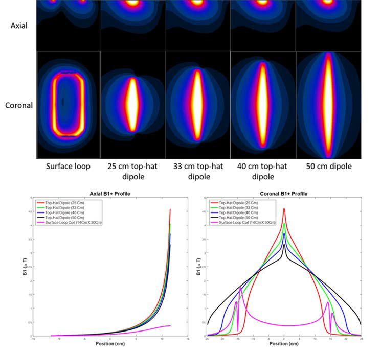 Axial과 coronal 방향에서 각 RF coil의 B1 field 비교 (상단), axial 방향에서의 B1 field의 profile 비교 그래프 (하단 왼쪽), coronal 방향에서의 B1 field profile 비교 그래프(하단 오른쪽)