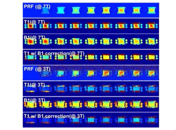 3 T MRI와 7 T MRI에서 PRF 기반 온도영상과 T1, T2의 변화량