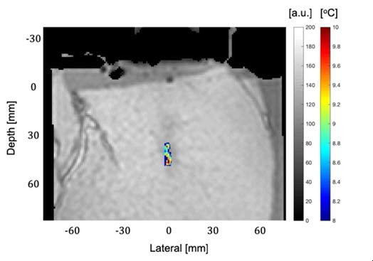 Ex-vivo Swine Tissue의 MR 온도영상