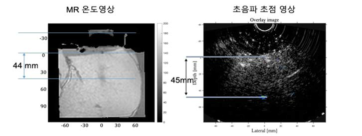 Ex-vivo Swine Tissue에서 MR 온도영상과 초음파 초점영상을 비교한 영상