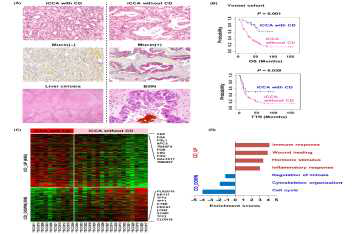 Histopathological and transcriptomic characteristics of intrahepatic cholangiocarcinoma (iCCA) with cholangiolocellular differentiation (CD) and iCCA without CD