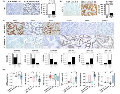 Immunohistochemical analyses of candidate marker genes for intrahepatic cholangiocarcinoma (iCCA) subtypes