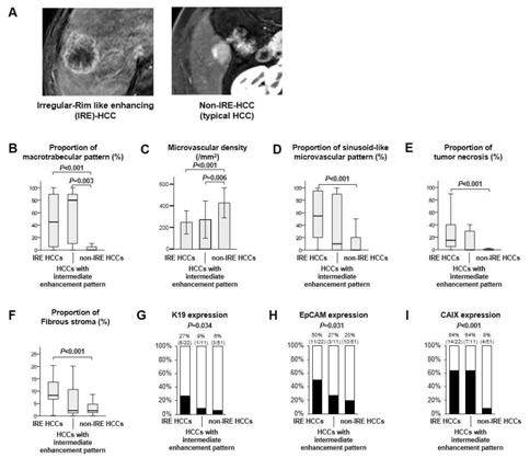 Comparison of histopathologic characteristics between irregular rim-like enhancement (IRE)-HCCs and non-IRE-HCCs based on the combined results of two reviewers’ classifications