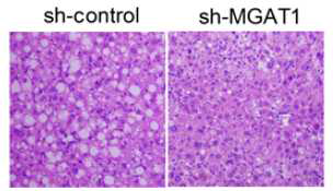 12주간 고지방식이를 한 마우스에 sh-MGAT1을 아데노바이러스 형태로 주입하고 1주일 후 마우스에서 지방간 유무를 관찰한 결과 MGAT1의 발현 억제시 지방간이 치료됨을 보임