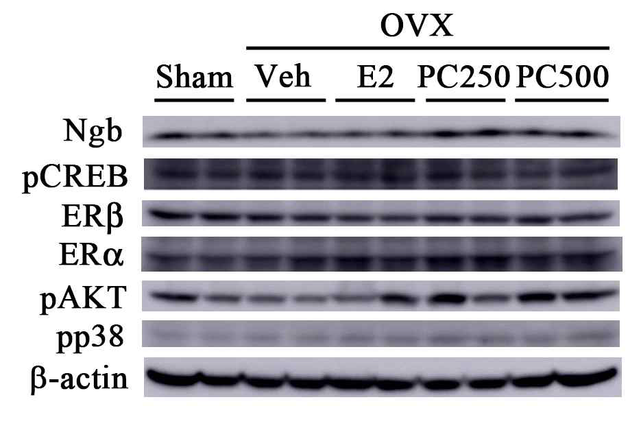 난소적출 동물에서 PC 추출물에 의한 Ngb 단백질 발현양 변화