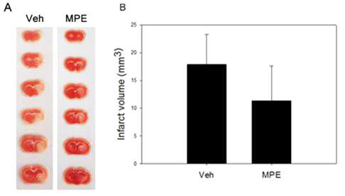 Ngb activator인 MP 추출물의 뇌경색감소 효과