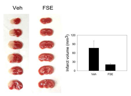 Ngb activator FS 추출물의 뇌경색감소 효과