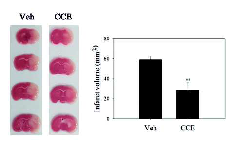 Ngb activator인 CC 추출물의 뇌경색감소 효과