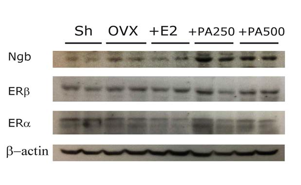 난소적출 동물에서 PA 추출물에 의한 Ngb 단백질 발현양 변화