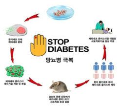 줄기세포 유래 베타세포 클러스터를 이용한 세포 치료