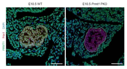 췌장 선조 세포 특이적 Prmt1 제거 마우스 (Prmt1 PKO)에서 췌장 선조 세포에서 Prmt1의 제거가 성공적으로 일어난 것을 면역 조직 형광 염색을 통해 확인하였음