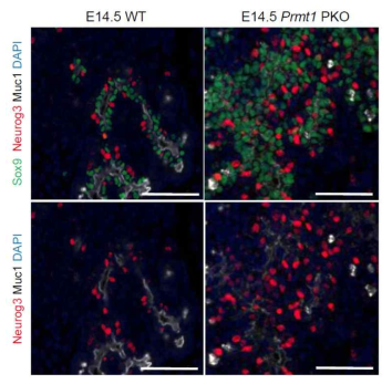 췌장 선조 세포 특이적 Prmt1 제거 마우스 (Prmt1 PKO)에서 embryonic day (E) 14.5부터 NGN3 (red)의 발현이 정상 대조군에 비해 증가하는 것을 확인하였음