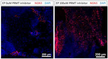 EP 분화 단계에서 Prmt1 inhibitor 100uM 처리하여 Prmt1의 작용 억제한 상태로 분화를 진행한 줄기 세포에서 NGN3의 분해가 억제로 인하여 NGN3를 발현하는 내분비 선조 세포의 수득률이 현저히 증가함을 면역 조직 형광 염색을 통해 확인하였음