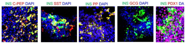 유도 역분화 줄기세포로부터 내분비 세포로의 분화 검증