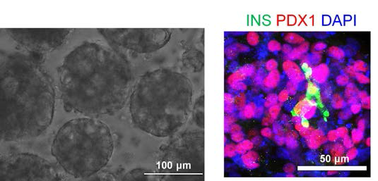 역분화 줄기세포 유래 베타세포 클러스터의 형성