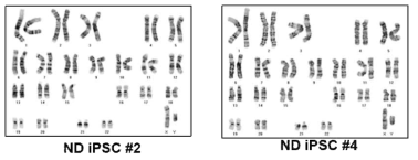 신생아 당뇨병 환자 특이적 유도 역분화 줄기세포의 핵형 분석