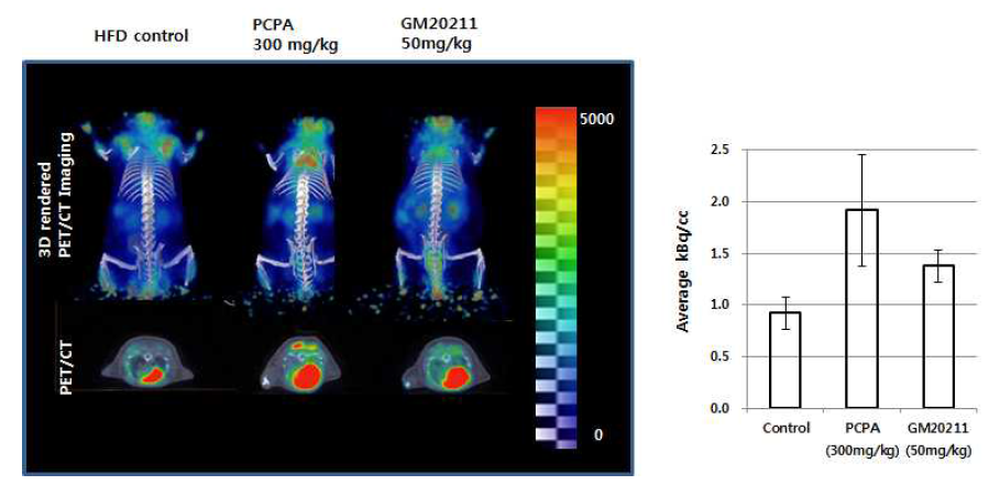 PET / CT images of F-18 FDG in BAT following administration of PCPA and GM20211