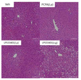 고지방 식이 마우스에 세로토닌합성 억제제를 투여한 후의 간의 H&E 염색사진