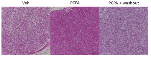 PCPA 투여 및 투여 중단 후의 갈색지방 H&E 염색사진
