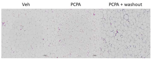 PCPA 투여 및 투여 중단 후의 내장지방 H&E 염색사진